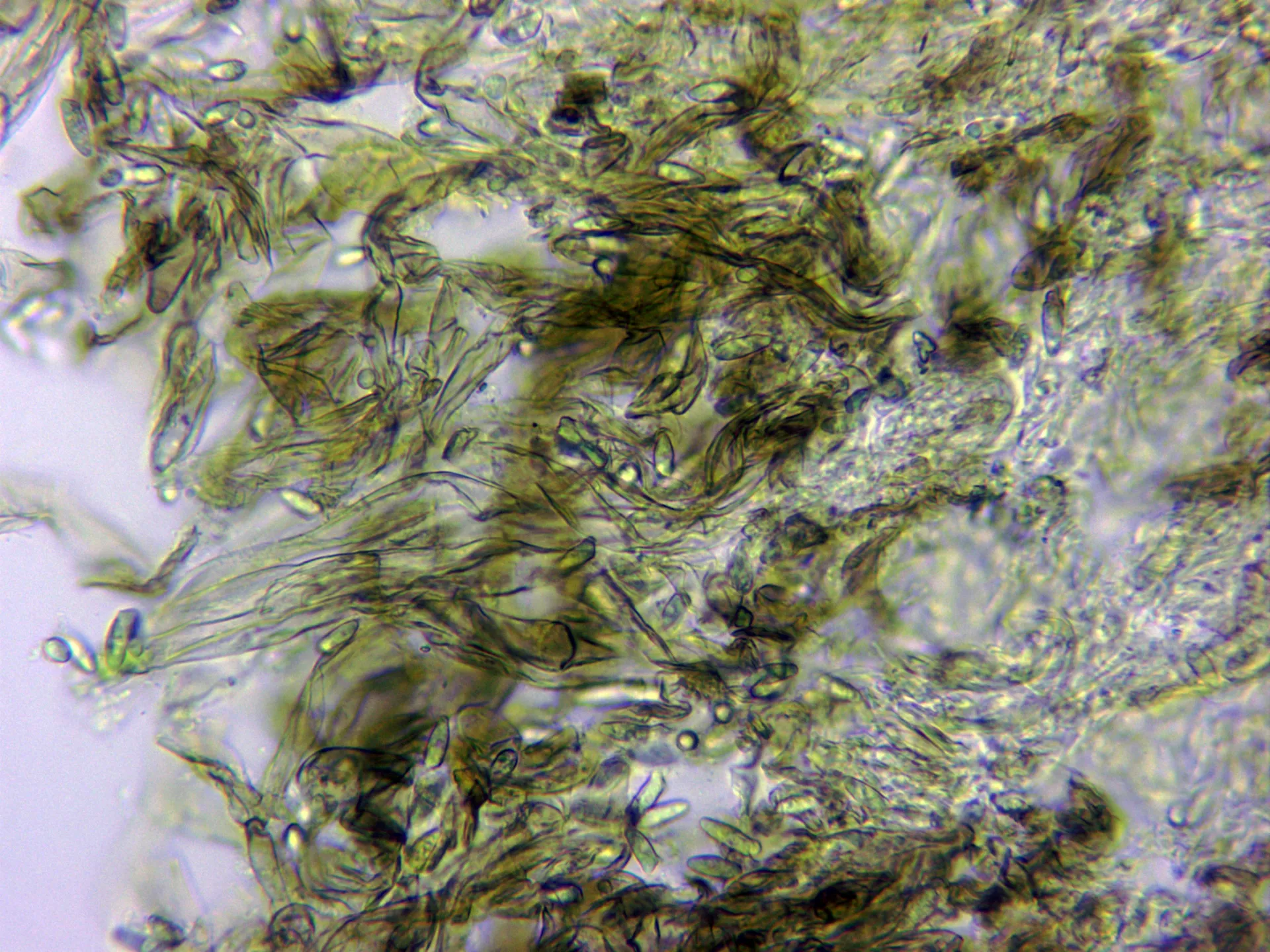 Microscopía de Lepiota castanea - 6 - Pileipellis agua x 400